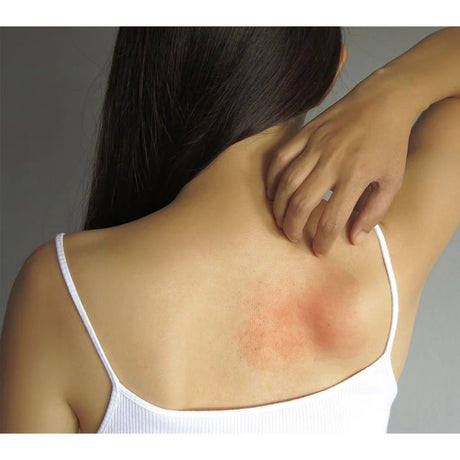 Allergie Test-Paket - Thats me Organic
