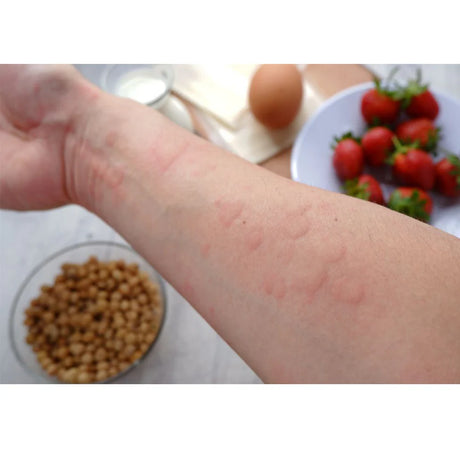 Allergie Test-Paket - Thats me Organic